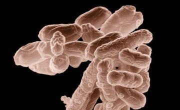 COLIFORM BACTERIA