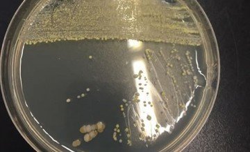 MESOPHILIC AEROBIC BACTERIA ANALYSIS