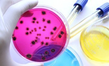 MICROBIOLOGICAL ANALYSIS