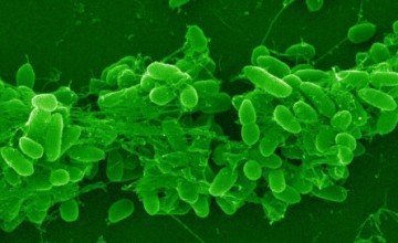 Pseudomonas Aeruginosa Analysis