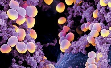 Staphylococcus Aureus Analysis