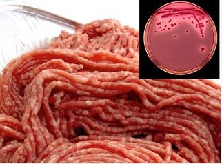 Serious Hazard in Meat Products: E.coli O157