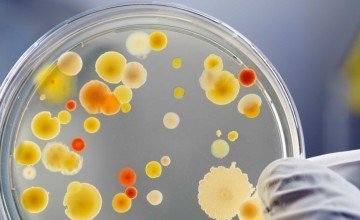Current Microbiological Analysis Limits in Cosmetics