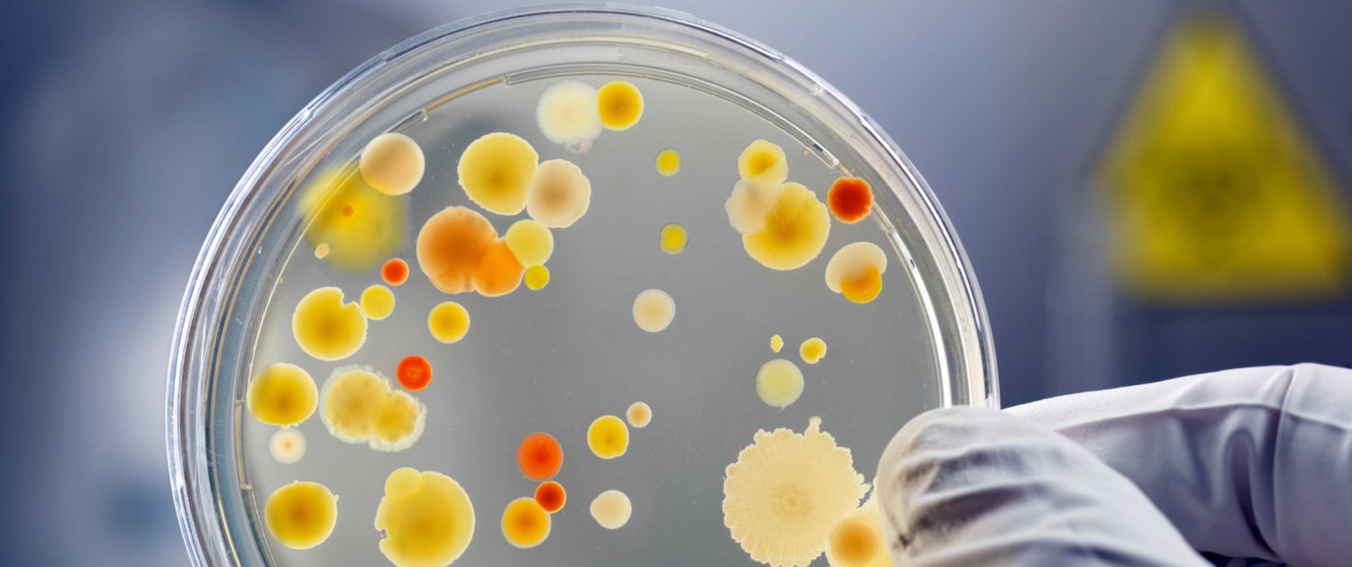 Current Microbiological Analysis Limits in Cosmetics