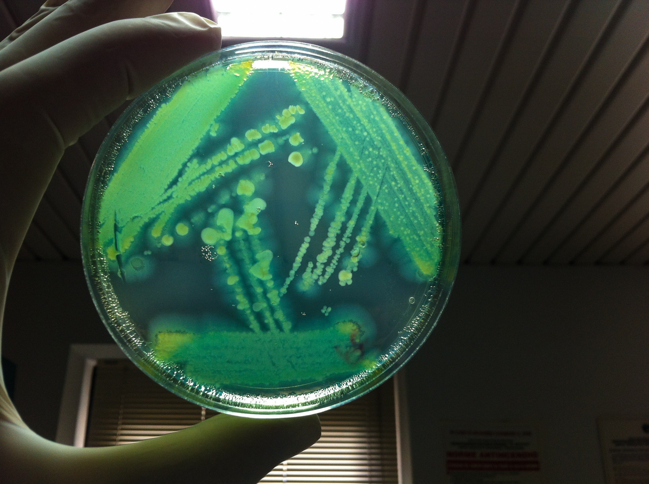 Microbiological Analysis of Equipment, Personnel and Air